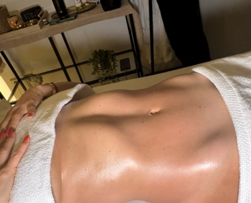After — Abdomen sculpting result
